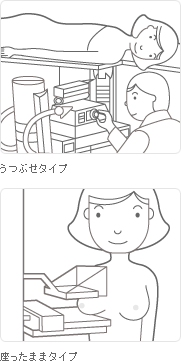 マンモグラフィ検診
